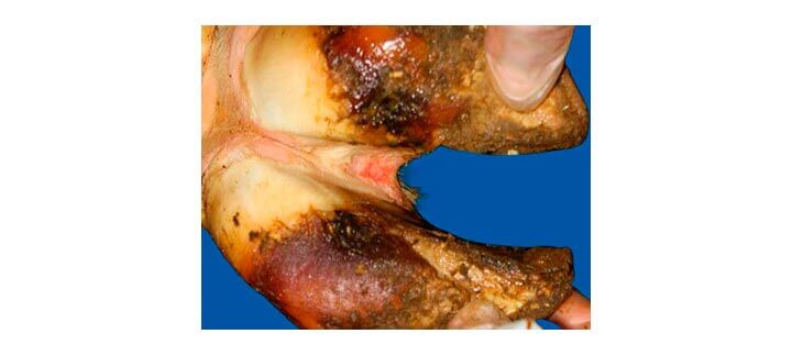 Post. Afecções Podais. Dermatite Interdigital. Post. Afecções Podais. Dermatite Interdigital.