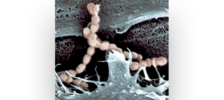 Streptococcus Suis | Nutrição Animal - Agroceres Multimix Streptococcus Suis | Nutrição Animal - Agroceres Multimix